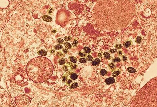 世界上最恐怖的病毒排行榜 最恐惧的病毒前五名