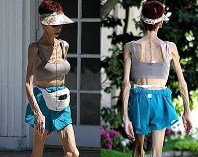 令人膛目结舌的世界32例人体之最 最奇葩的人体之最