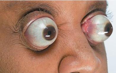 令人膛目结舌的世界32例人体之最 最奇葩的人体之最