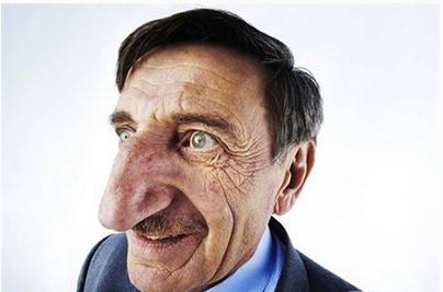 令人膛目结舌的世界32例人体之最 最奇葩的人体之最