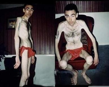 令人膛目结舌的世界32例人体之最 最奇葩的人体之最