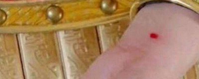 ​守宫砂是什么