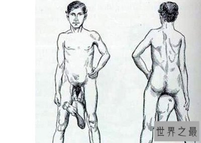 ​世界十大怪胎：狮面人上榜，竟存在拥有两个阴茎的男人