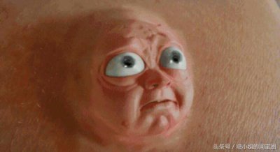 ​有史以来最全的关于痘痘闭口的合集！有图有真相！